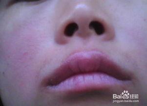 小孩吃瓜嘴过敏怎么办,快速处理及预防措施